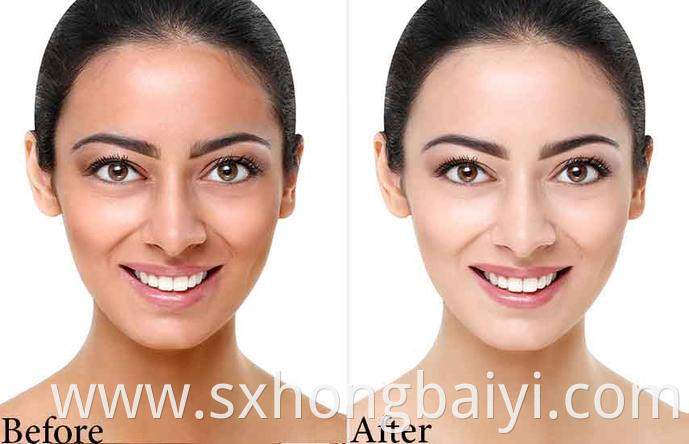 Before After Skin Whitening Zeta White 345x 2x